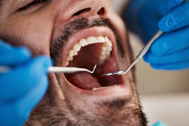 Best Urgent Care for Lost Fillings or Crowns in Lakeport, TX