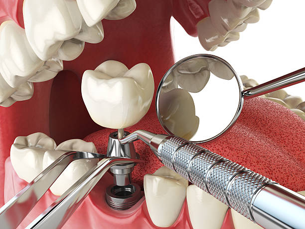 Best Emergency TMJ Treatment in Lakeport, TX